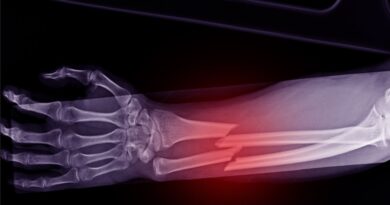 चीनी बोन ग्लू