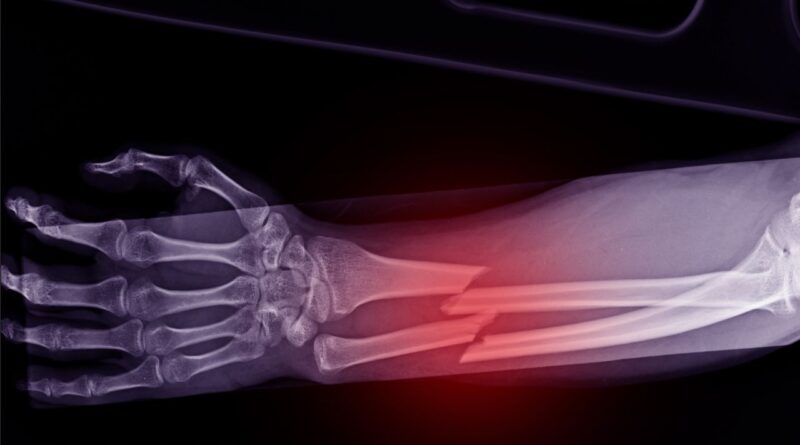 चीनी बोन ग्लू