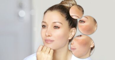 liver damage skin signs