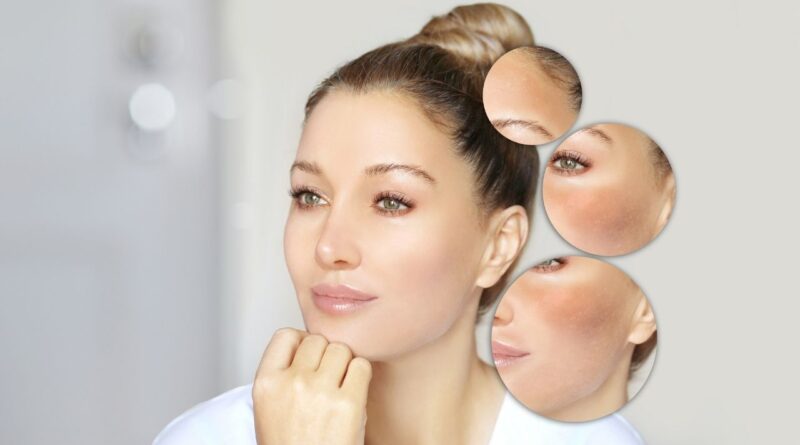 liver damage skin signs